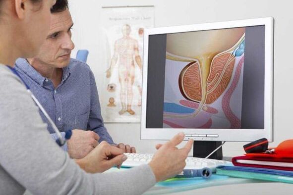 dokter berkonsultasi dengan pasien tentang masalah prostatitis