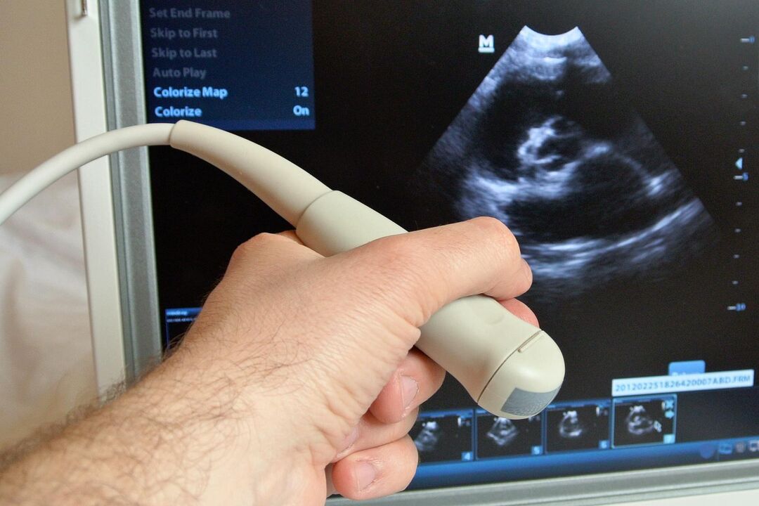 Ultrasonografi akan membantu mendiagnosis prostatitis kongestif pada pria