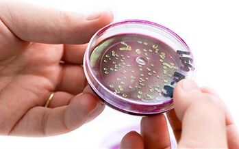 Bakteri dalam sekresi prostat